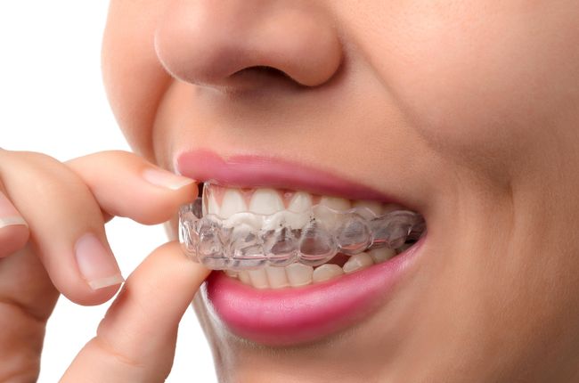 Invisalign Invisalign